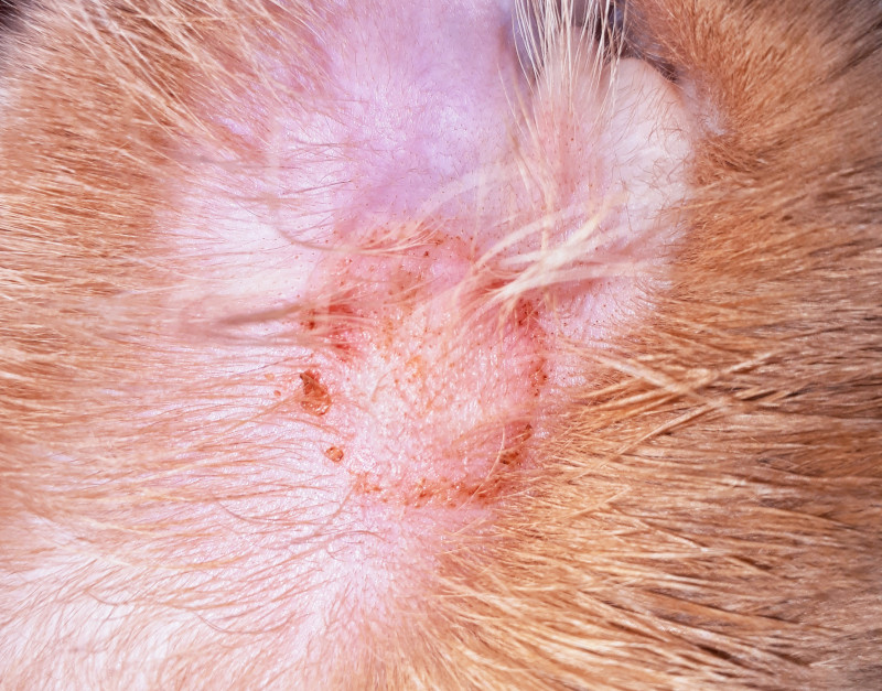 Ringworm: Treatment, symptoms, and pictures